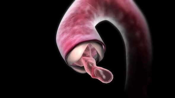 Aortic valve allows one-way blood flow from the heart