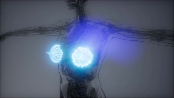 Medically Accurate Illustration of an Obese Womens Mammary Glands alt