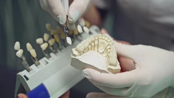 A doctor in latex gloves is holding in his hand an cast of the jaw with teeth and selecting crowns