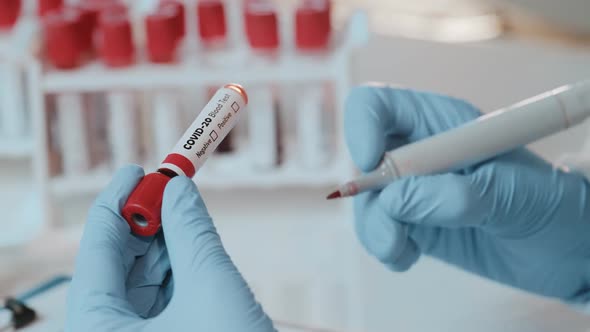 Close Up of Doctors Hand Holding Tube with Positive Blood Test for COVID-20