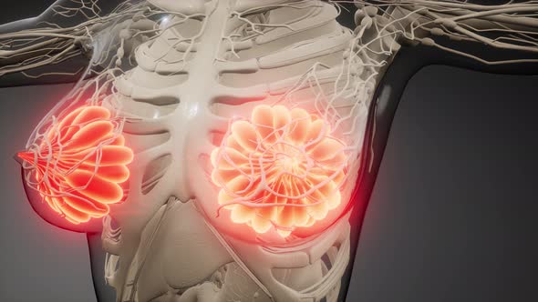 Medically Accurate Illustration of an Obese Womens Mammary Glands alt