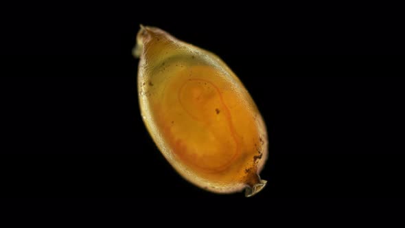 Movement of young worms in a cocoon under a microscope, family Lumbricidae