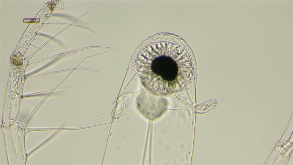 Zooplankton Under a Microscope