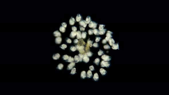 Vorticella Colony Under a Microscope