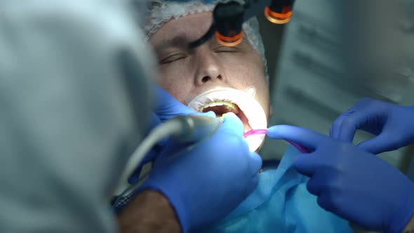 Closeup Drilling Ill Tooth in Dental Clinic in Slow Motion