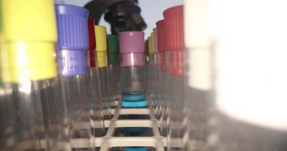 Scientist in Gloves Takes Out Test Tubes with Liquids Closeup