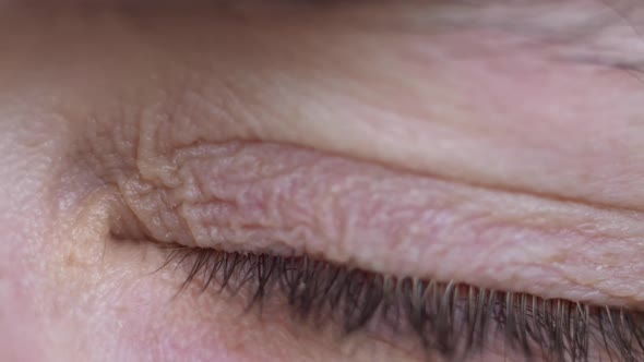 Close-up of Hazel Male Eye Squeezes tightly closed