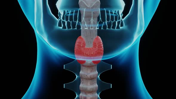 Nodular goiter occurs when the thyroid gland does not produce enough thyroid hormone for the body