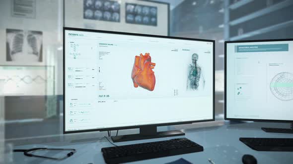 Medical Scan Of Heart Artery In Analysis Software Discovers Cardiac Ischemia