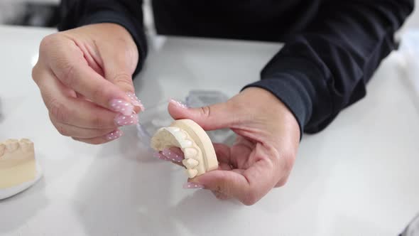 Woman attaching veneers to jaw cast