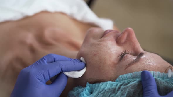 Woman on the Procedure of Mesotherapy Injection with a Syringe