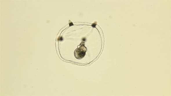 Small Medusa Under a Microscope, Class Hydrozoa, Type Cnidaria, Size About 1Mm