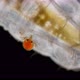 Larva Mite Hydrachnidia and Hydrophilidae Larva Under a Microscope - VideoHive Item for Sale