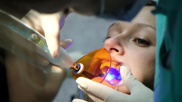 Assistant Shines with a Dental Polymerization Ultraviolet Lamp on the Patients Teeth Close-up. Visit