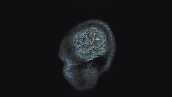 Bulk Multicolored MRI Brain, Head Scans and Tumor Detection. Diagnostic Medical Tool