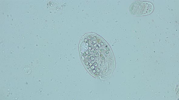 infusorium Ciliophora Subclass Hypotrichia under a microscope, Class Spirotrichea