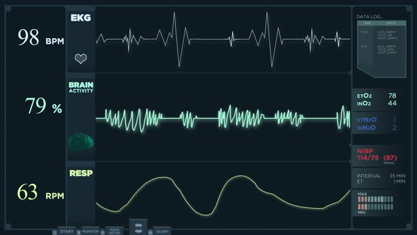 Fast Electrocardiogram Reading Display.