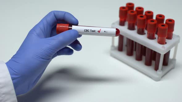 Negative CBC Test, Doctor Showing Blood Sample, Lab Research, Health Checkup