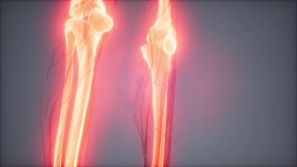 Transparent Human Body with Visible Bones alt