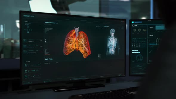 Doctor is Investigating the Patient's Lungs for virus Diagnosis using Software alt