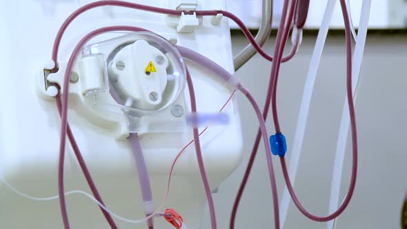 hemodialysis in people on the equipment