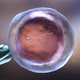 In Vitro Fertilization - VideoHive Item for Sale