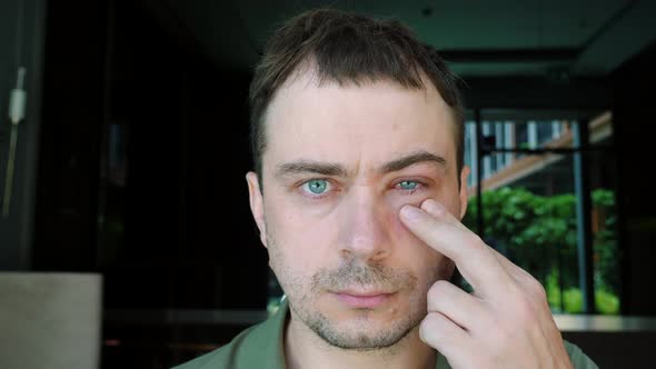 Serious Adult Man with Injured Eye with Inflammation Touch Face By Hand Pain