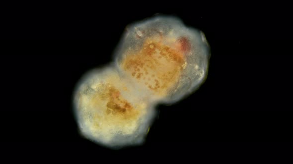 Cocoon of the Worm Tubifex Tubifex Under the Microscope