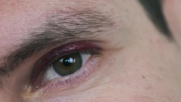 Bruise Over the Eye of a Man Closeup