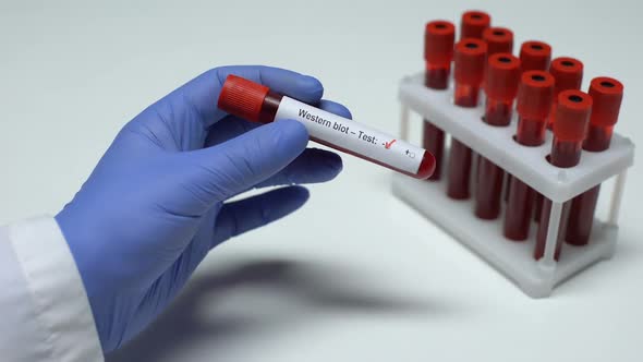 Negative Western Blot Test, Doctor Showing Blood Sample in Tube, Health Checkup