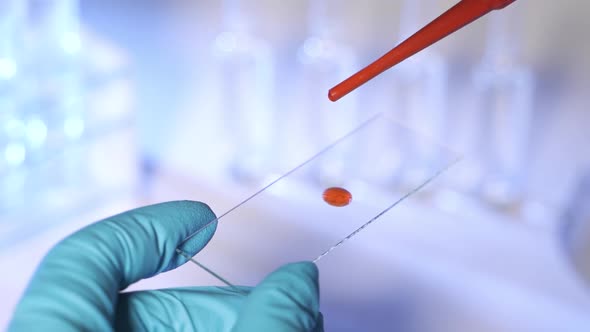 Lab Technician Holding Pipette and Testing Blood Samples on Hospital Ward for Blood Transfusion