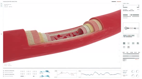 Modern scanning technology is used for the analysis of the patients arteries