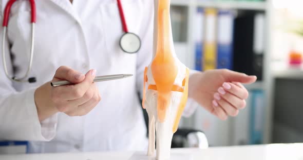 Traumatologist Demonstrates Bones of Knee Joint on Artificial Model Closeup