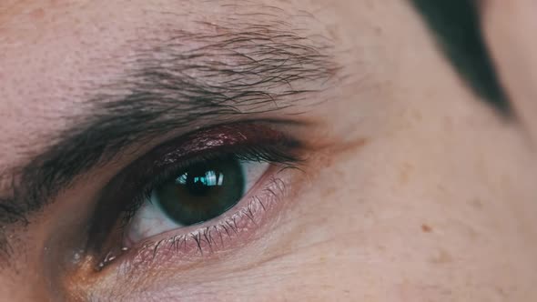 Real Black Eye on the Young Male Face Bruise on a Man Eyelid