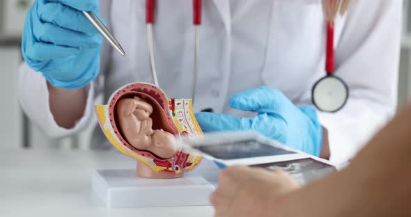 Obstetrician Gynecologist Shows Woman Artificial Model of Fetus of Child and Ultrasound of Fetus