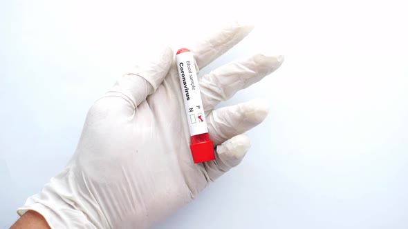 Hand in Blue Medical Gloves Holding Blood Test Tube on White Background