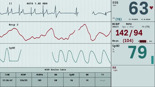 Modern medical equipment is showing a rapid decline in the patients pulse