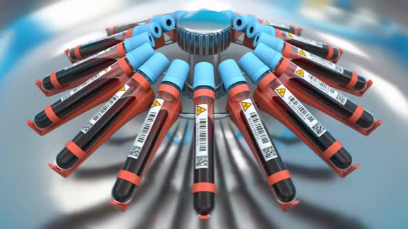 Medical Research Laboratory and Centrifuge with Blood Samples Tubes Making Tests