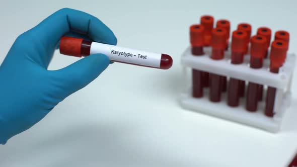 Karyotype, Doctor Showing Blood Sample in Tube, Lab Research, Health Check-Up