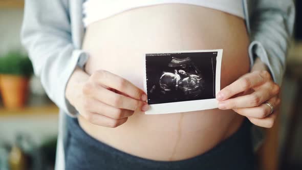 Close-up Shot of Pregnant Woman's Belly and Female Hands Holding Ultrasound Image of Healthy Unborn