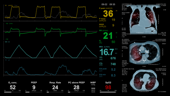 Medical Screen. COVID 19. 4K