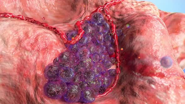 Division and growth of cancerous cells