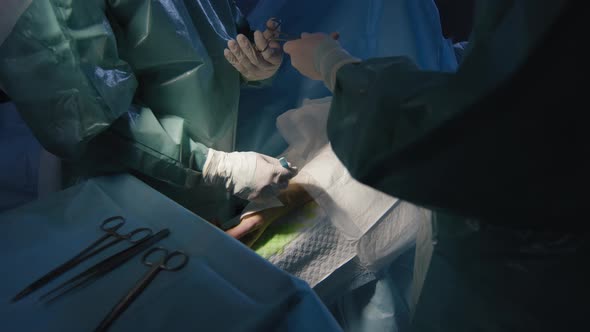 Doctors Doing Surgery On Arm