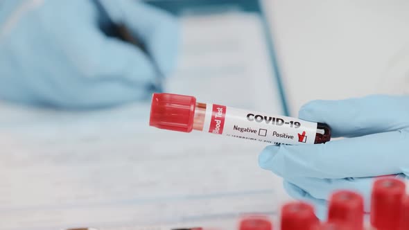 Hand of Doctor Holds Test Tube with Sample of Positive COVID-19 Analysis