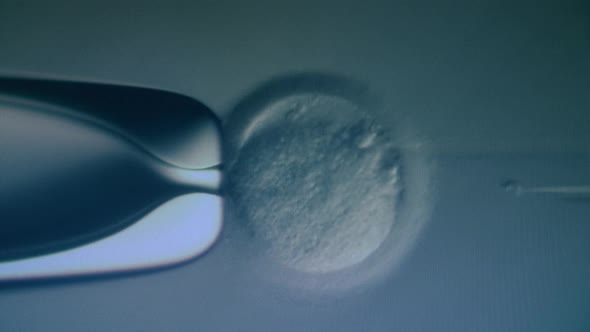 In Vitro Fertilization Under a Microscope