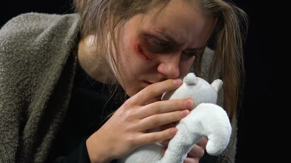 Bruised Woman Hugging Toy, Victim of Kidnapping Missing Family, Physical Abuse