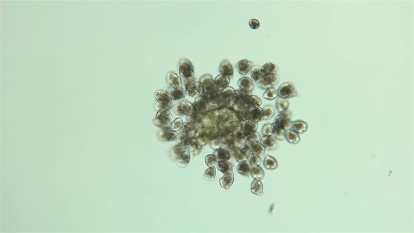 Vorticella Colony Under a Microscope