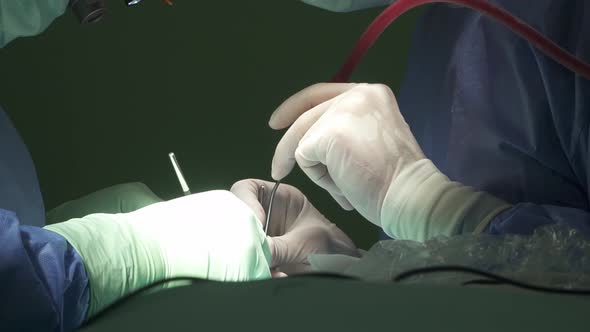 Unrecognizable medics performing surgery in operating room