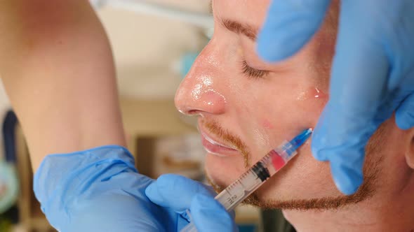 Beautician Applying Acid Peeling Solution on Male Client Face Rubbing with Gloved Hands