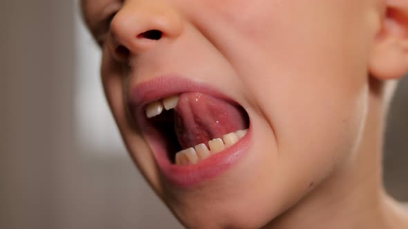 The Boy Smiles and Shows His Fallen Baby Teeth